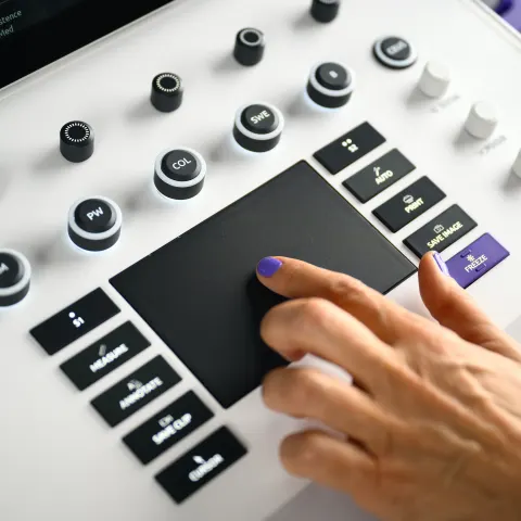 Main sur le pavé tactile d'un échographe Supersonic Imagine